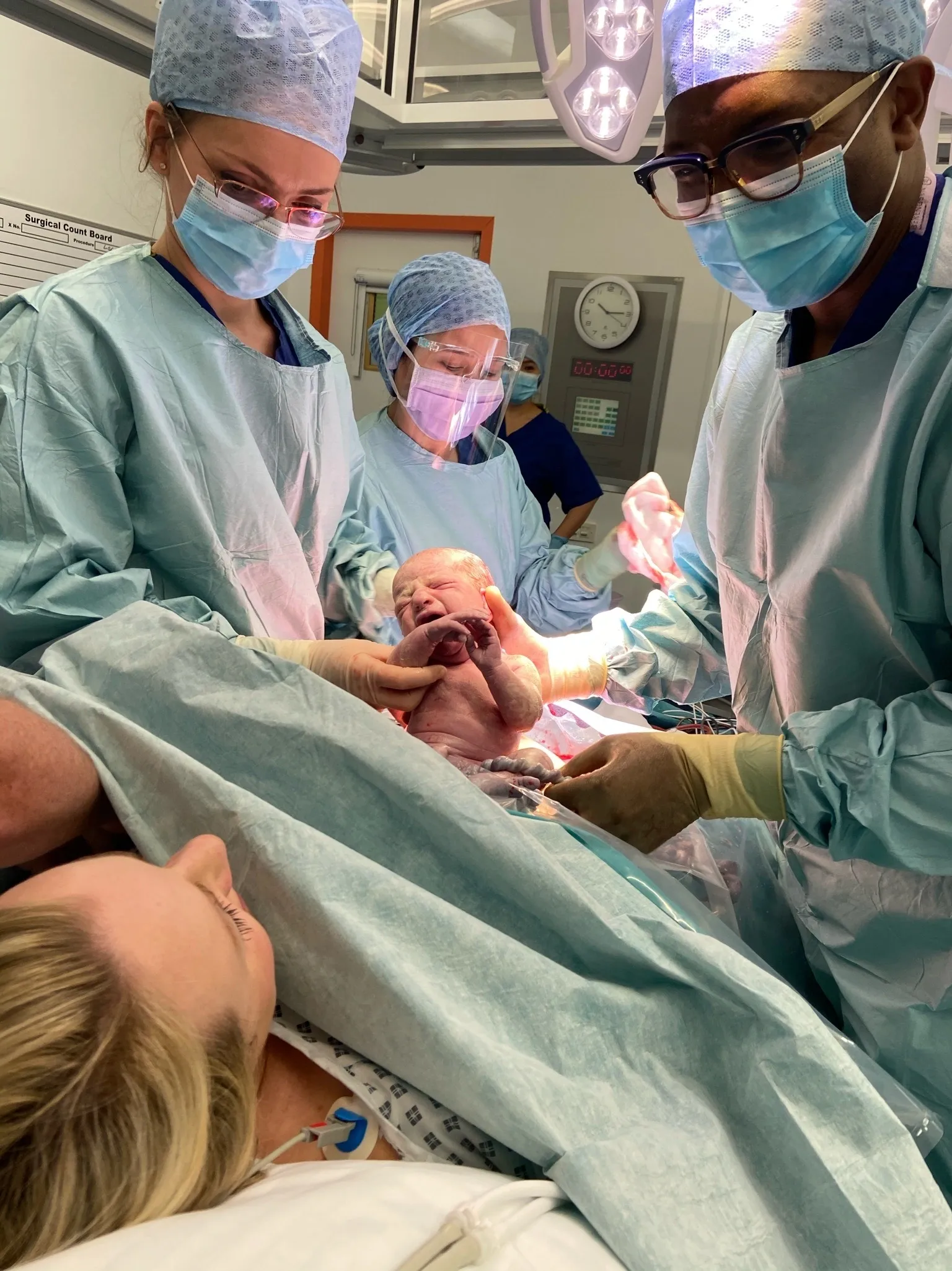 Caesarean birth delivery